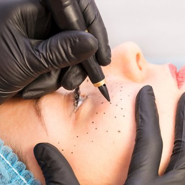  Freckles are back czyli piegi permanentne w nowoczesnym wydaniu