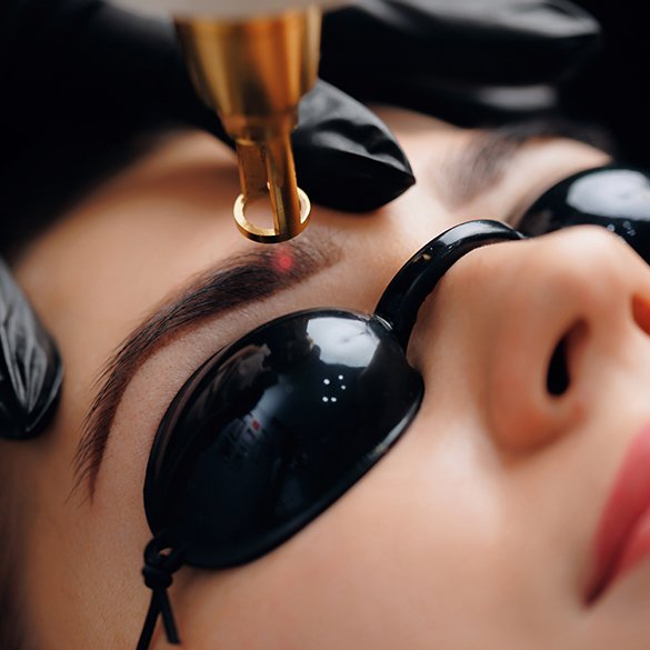  Usuwanie makijażu permanentnego 